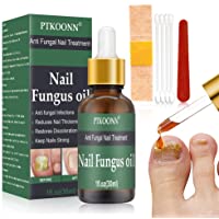 Reparar Las Uñas，Anti Hongos De Uñas- Tratamiento De Uñas- Aceite Nutritivo Líquido- Tratamiento anti hongos en las uñas…